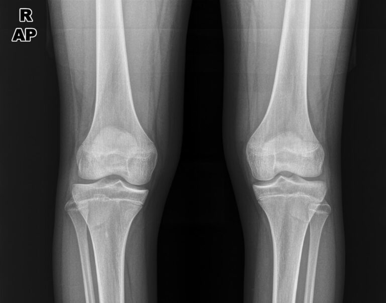 What is the Growth Plate?